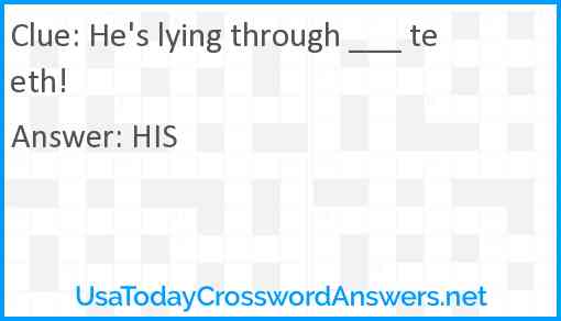 He's lying through ___ teeth! Answer
